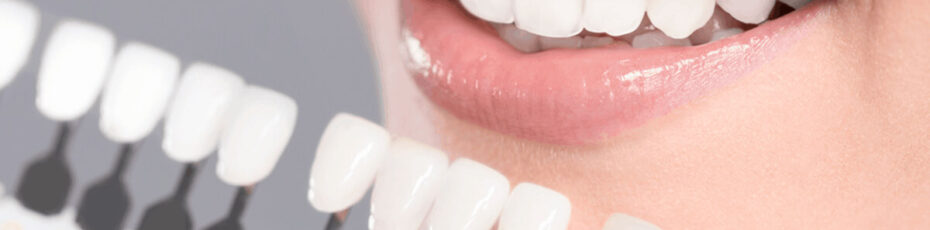 how to rebuild your smile with dental veneers