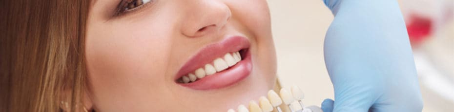 how to transform your smile with veneers