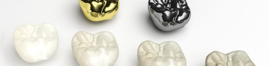 the necessity of dental crowns