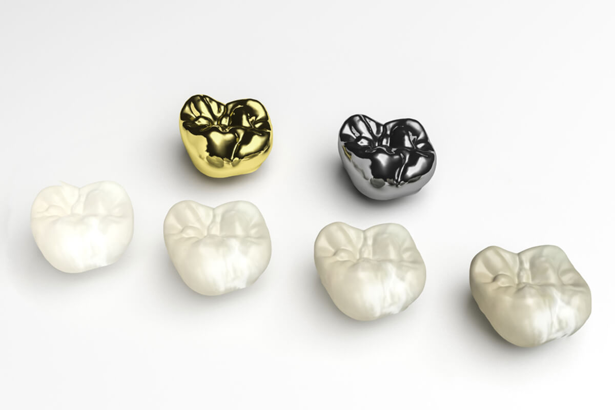 the necessity of dental crowns