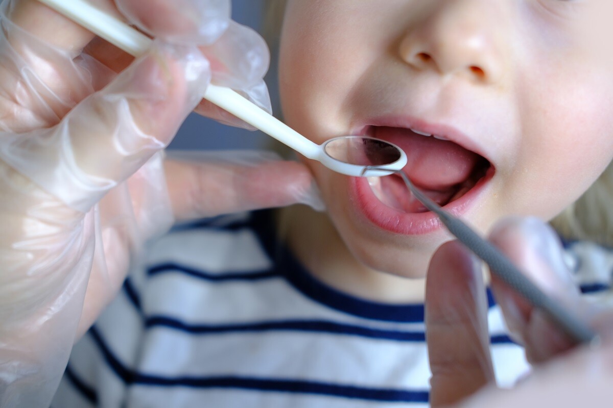 what do shark teeth mean for a child’s oral health and how do you identify one