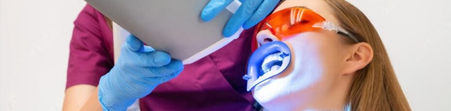 10 reasons to consider laser teeth whitening treatment