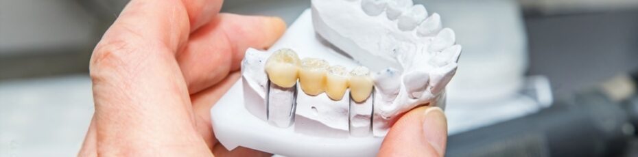 the pros and cons of eating after getting a dental bridge