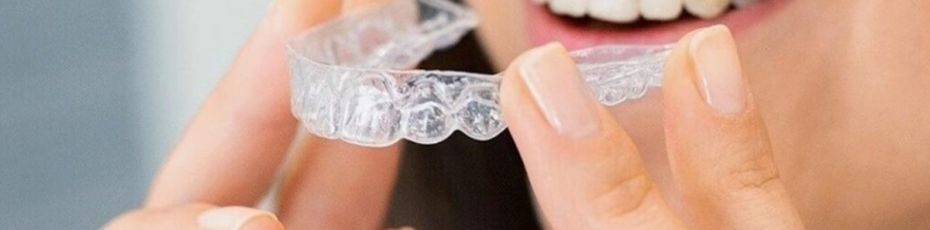 tips to speed up the process of invisalign