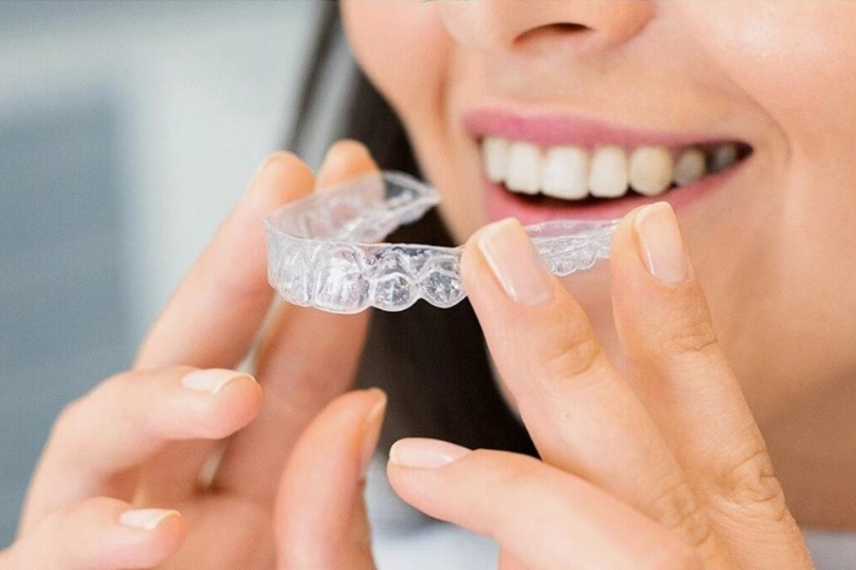 tips to speed up the process of invisalign