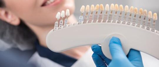 guide for porcelain veneers
