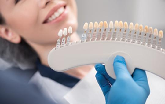 guide for porcelain veneers