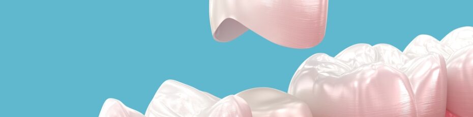 How Crowns Improve the Strength and Appearance of Damaged Teeth