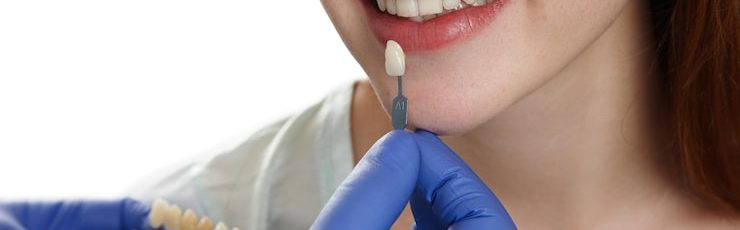 Dental veneers for enamel damage treatment guide